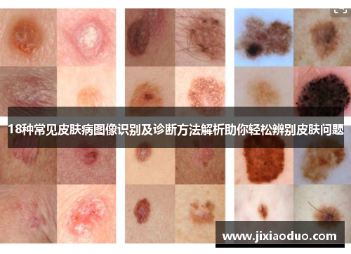 18种常见皮肤病图像识别及诊断方法解析助你轻松辨别皮肤问题